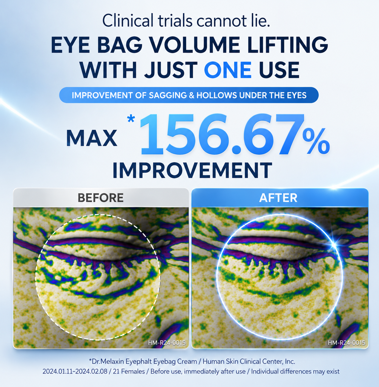 Eyephalt Eyecream by Dr. Melaxin